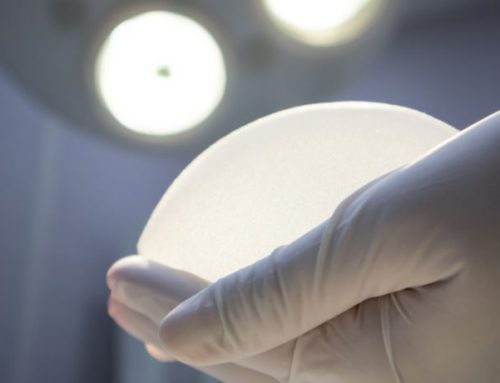 Is Breast Implant Surgery Right for Me?